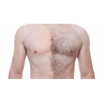 DEPILACIÓN TÓRAX CON CERA - Imagen 1