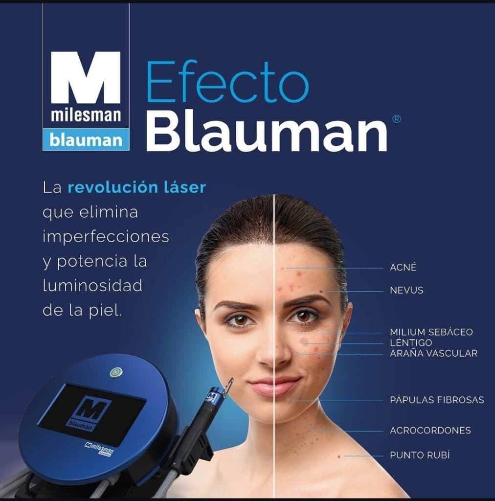 MILESMAN BLAUMAN LASER AZUL