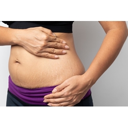 TRATAMIENTO POSPARTO Y CESÁREA 50 MIN ROCÍO RODRIGUEZ - Imagen 1